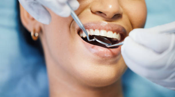 Best Cosmetic Emergency Dentistry in Palo Alto, CA